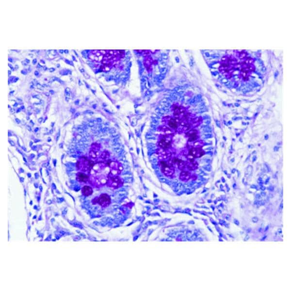 PAS: Periodic Acid-Schiff Stain Hematoxylin I 500mL Ea