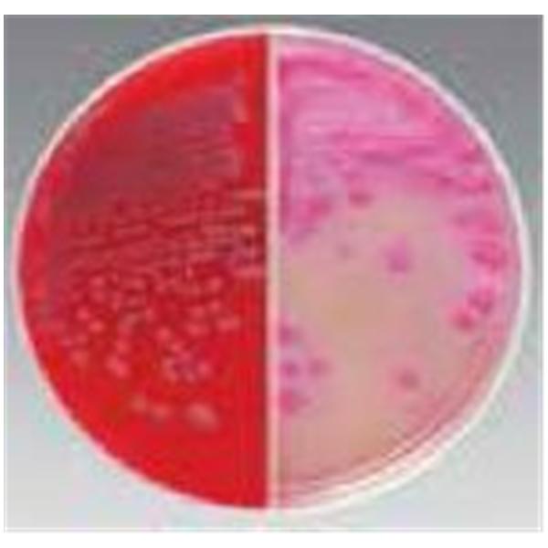 Culture TSA: Trypticase Soy Agar Biplate 100/Ca