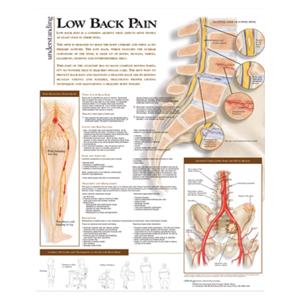 Understanding Low Back Pain 20x26" Anatomical Chart Ea