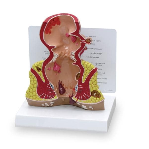 Rectum Anatomical Model Ea