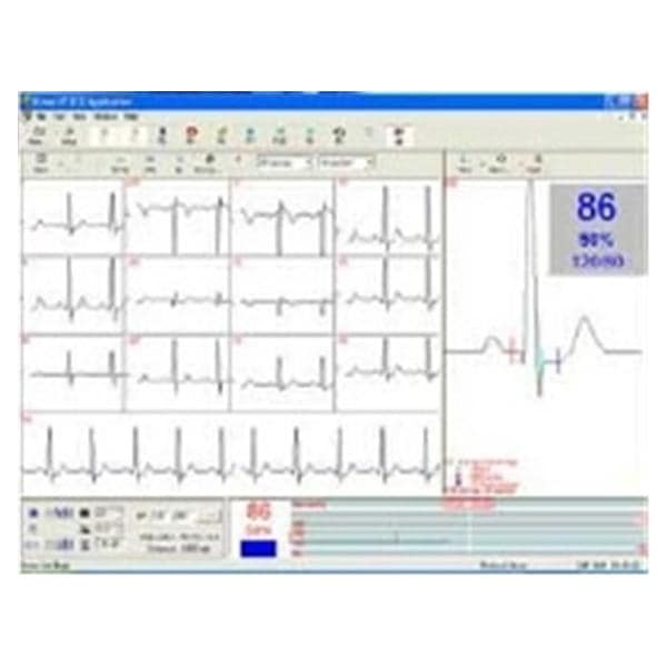 ECG Interpretation Software Ea