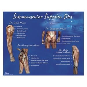 Intramuscular Injection Sites 18x24" Training Poster Ea