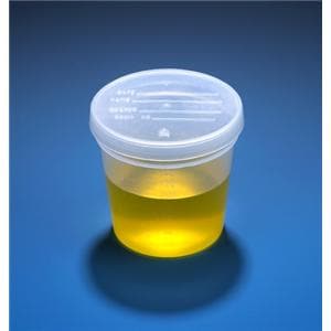 Specimen Container 5oz Polypropylene Non-Sterile 300/Ca