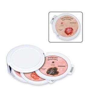 Skin Cancer Educational Disk Set Ea