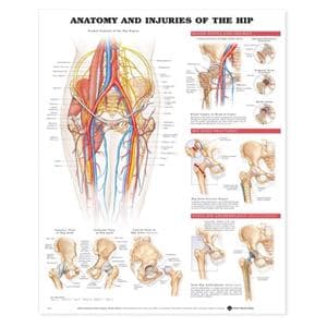 Anatomy & Injuries of the Hip 20x26" Anatomical Chart Ea