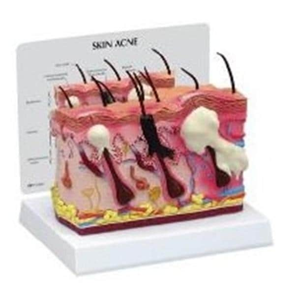 GPI Anatomicals Stomach Model Ea