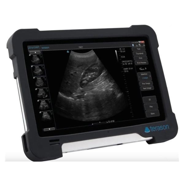 Usmart 3200T Ultrasound System Ea