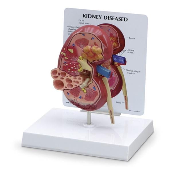 Kidney Anatomical Model Ea