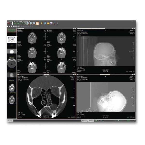 Opal Rad Pacs Software Ea