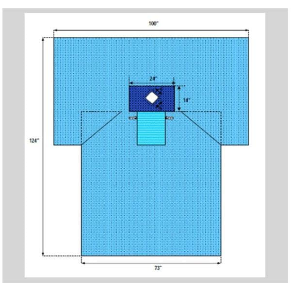 100x73x124" Non-Sterile Surgical Drape 5x5" Diamond Fenestrated