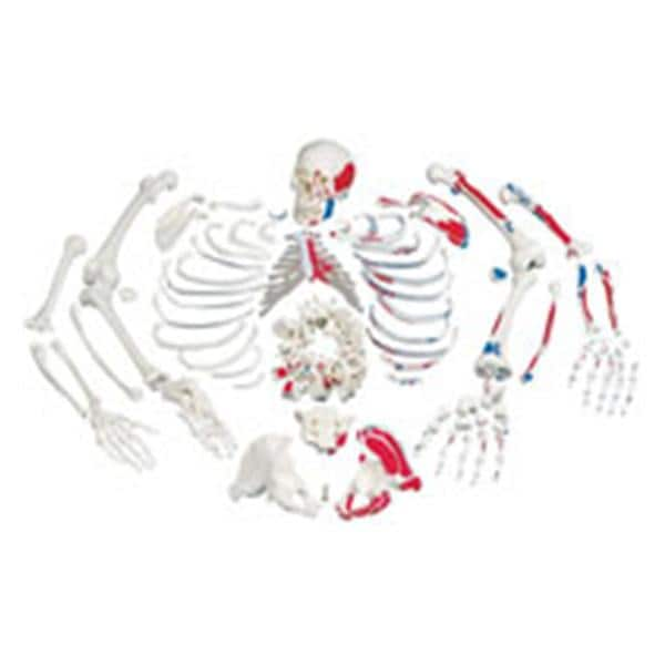 Disarticulated Skeleton Ea