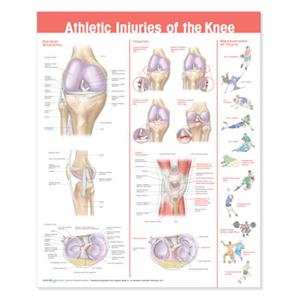 Athletic Injuries of The Knee 20x26" Anatomical Chart Ea