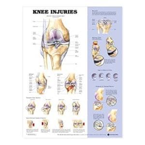 Chart Anatomical Knee Injuries Ea