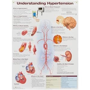 Understanding Hypertension 20x26" Laminated Wall Chart Ea