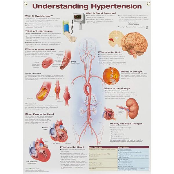 Understanding Hypertension 20x26" Laminated Wall Chart Ea