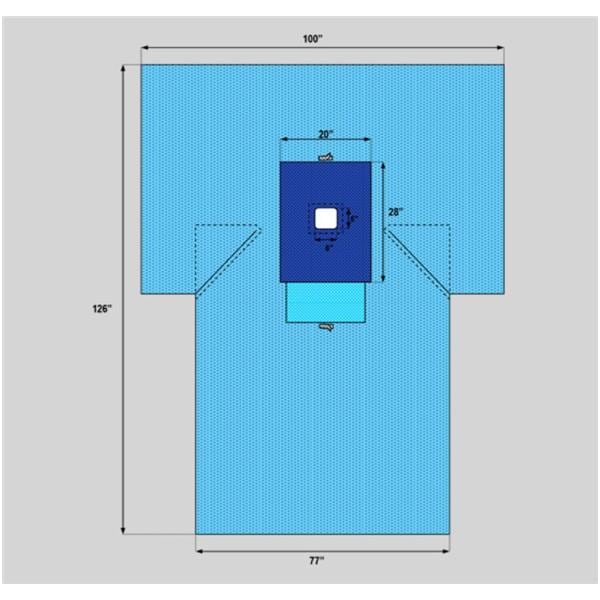 100x126x76" Sterile Drape T-Drape 6x6" Fenestrated