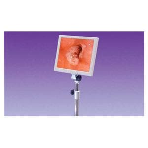 Only Monitor For Desktop/Galileo VC Colposcope Ea