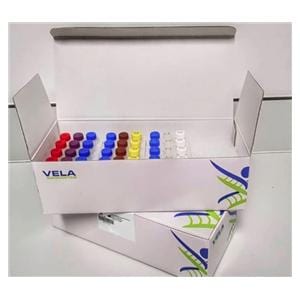 Sentosa SX VirusTNA Reagent EUA 184/Bx