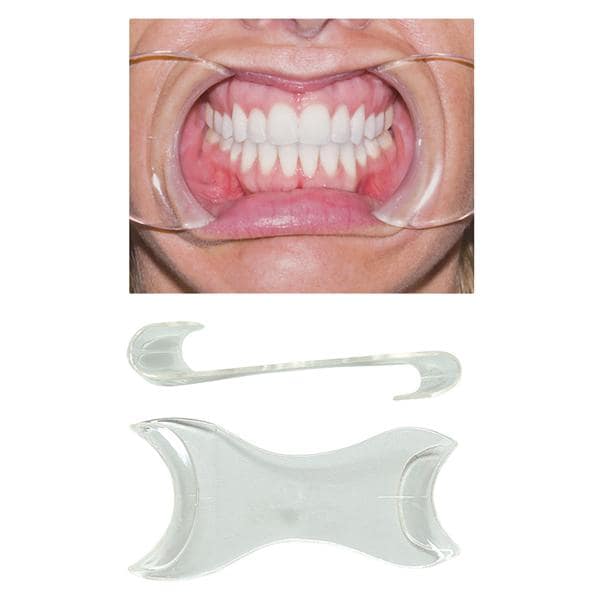 Cheek Retractor Child / Adult Clear 2/Pk