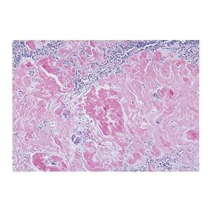 Amyloid Stain Kit Ea Ea