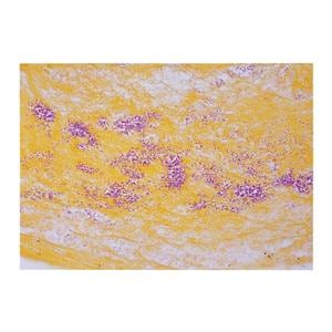 Gram Stain Tissue Ea Ea