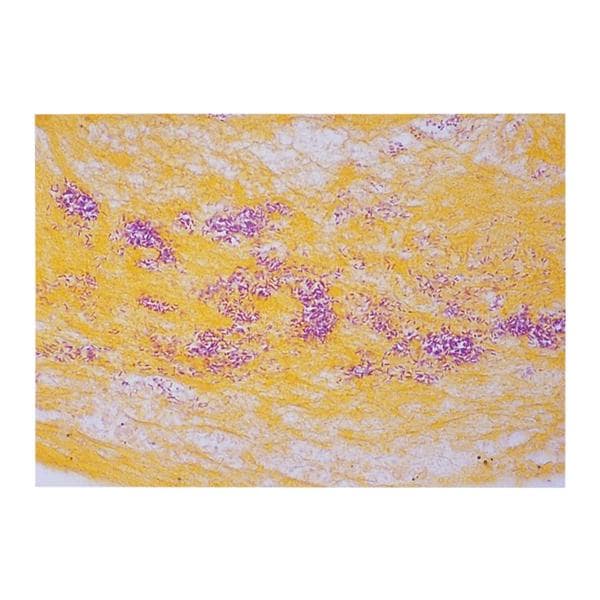 Gram Stain Tissue Ea Ea