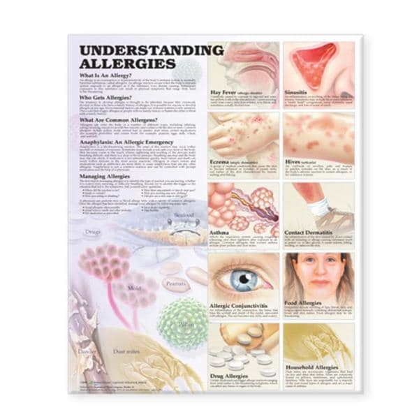 Understanding Allergies 20x26" Educational Chart Ea