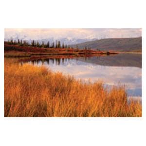 CeilingScenes Acoustic Tile Wonder Lake 1-Tile Horizontal 48 in x 24 in Ea