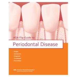 Flip Guide Periodontal Diseases 8 in x 13 in With 14 Pages Ea