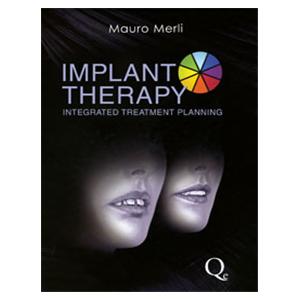 Book Implant Therapy: Integrated Treatment Planning Volume 1 Ea