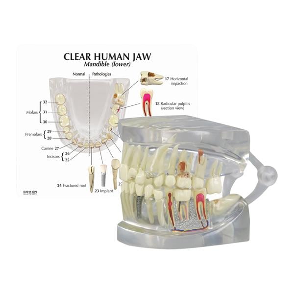 Patient Education Model Human Jaw 2 4/5 in x 2 1/2 in x 2 1/2 in Ea