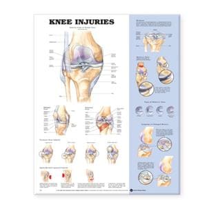 Knee Injuries 20x26" Anatomical Chart Ea