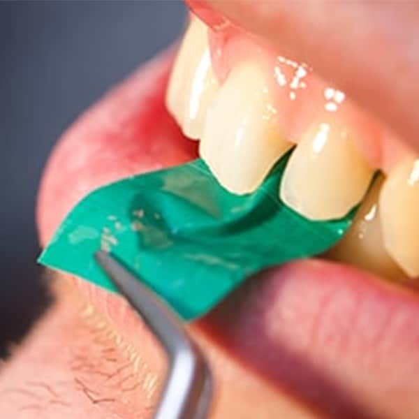 DENTAL ARTICULATING SOLUTIONS