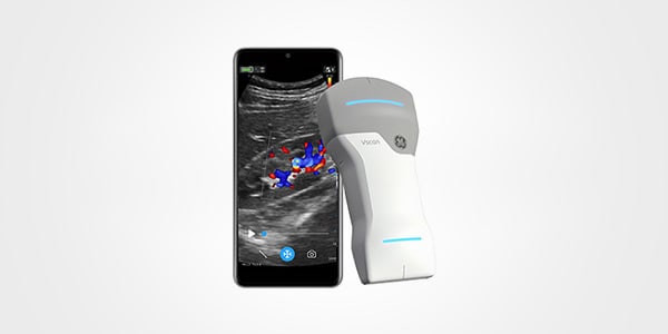 Featured Ultrasound Machine: Vscan Air™