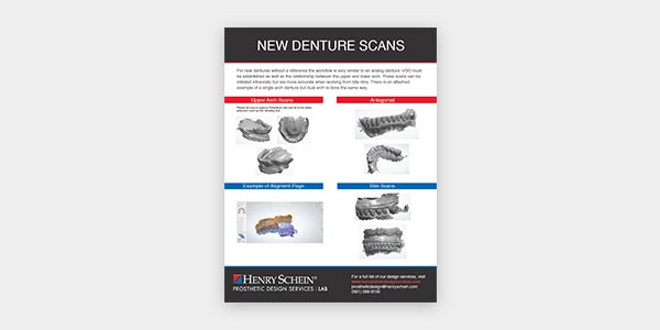 New Denture Scans