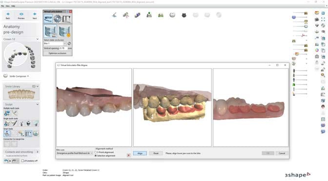 3Shape-Dental-System-2024_image-02