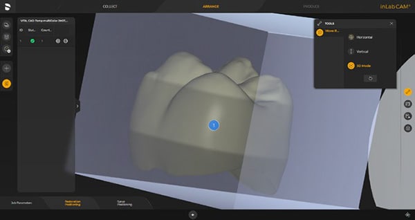 inLab CAD Software - Zahn Dental Labs