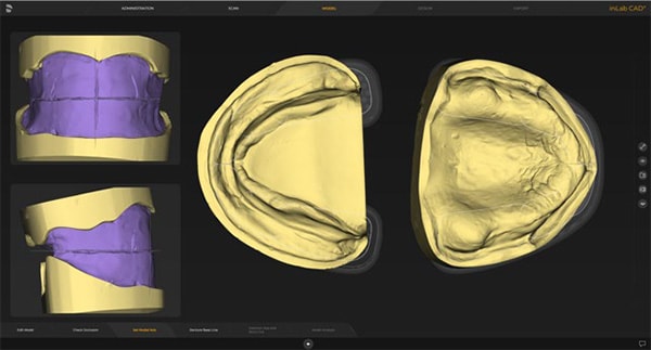 inLab CAD Software - Zahn Dental Labs