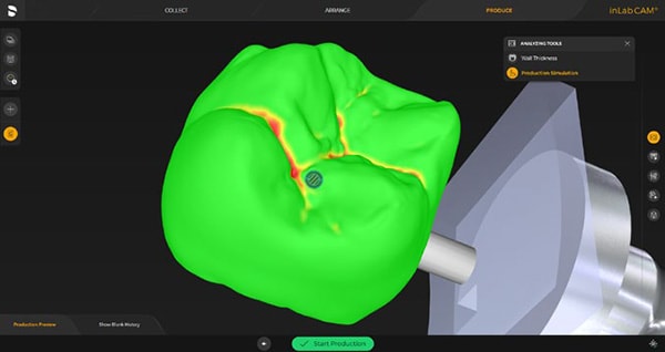 inLab CAD Software - Zahn Dental Labs