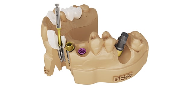 Soluciones odontológicas inteligentes DESS®